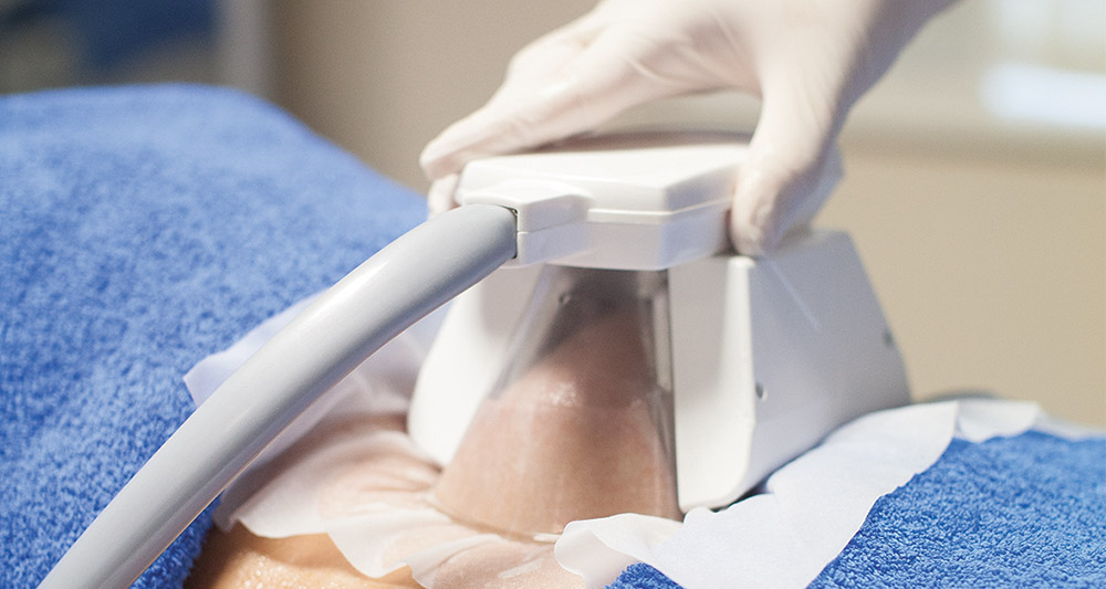 Multiple Areas in One Session HIFU and Fat Freezing Horsham