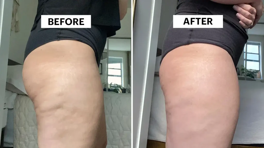 Do Toning Exercise Horsham Really Tackle Cellulite?