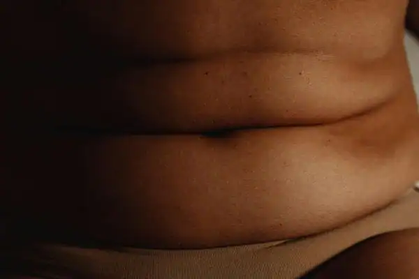 image of what stress can do on the stomach area and how Lipo 360 Horsham can help to change your body shape.